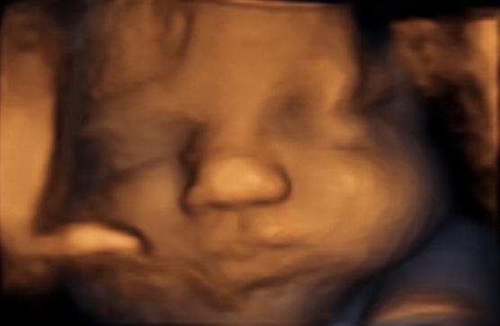 Een echo na 37 weken.